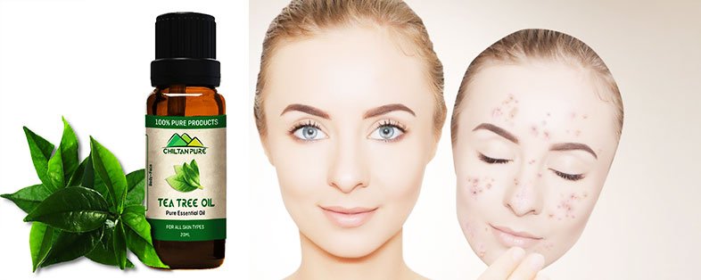 Tea Tree Oil For Facial Skin - Tea Tree Oil Uses For Skin