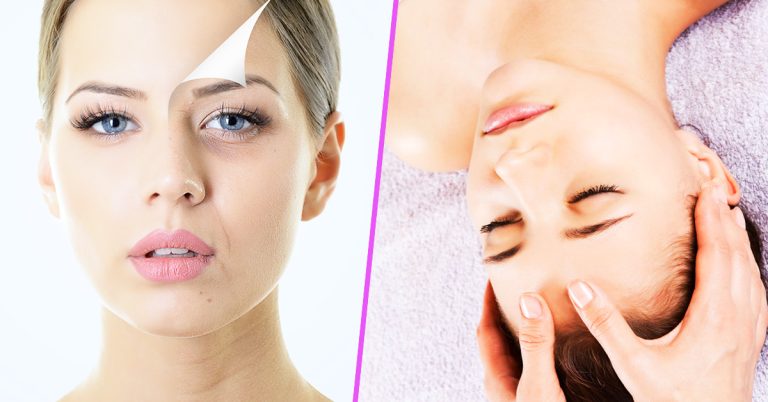 7 Small Steps How to Get Rid of Acne Scars Overnight